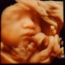 SeoulFace21(서울페이스21) | 21. 난임일기 : 30주차 입체 초음파 찍기, ai 베이비...챗gpt로 신생아 얼굴 예상, 대전 서울여성병원