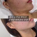 기가메디칼 | 청라피부관리 제대로 받고 온 후기｜여드름 진정까지 케어해주는 청라눈부심부티크