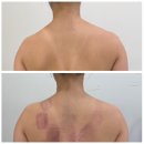윤케어바디 | 월곡 바디관리 타라테라피 얼국 윤과부터 바디케어 웨딩케어 솔직후기