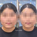 이화토탈뷰티샵 | 향남 피부관리 잘하는곳 뷰티토탈샵 비대칭 윤곽관리 후기 시크릿타임