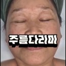 진스킨바디