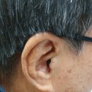 울림숲난청연구소 보청기 이미지