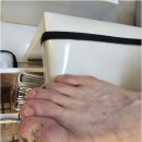 닥터아이티엔챈네일 | 세종내성발톱 발톱무좀까지 아버님 관리 성공 후기 발데렐라