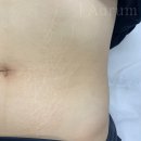 제이아우룸&스킨52