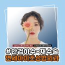 연세아이즈성형외과의원 이미지