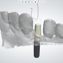 R - Dental 티스토리