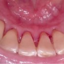 다인약국 | 노르다인 구강유산균 가격 효능 부작용 내돈내산 후기