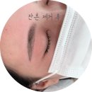 디헤어아트 안성점 | [비비드아트] 창원 붉은눈썹 상남동잔흔제거 후기