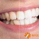 서울밝은미소치과의원 이미지