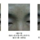 (주)유니셀 | 필러화장품-360안티링클 라인필러 후기