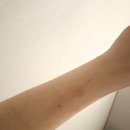 (주)휘트리딩 케어스테이션 | [출산후기]제왕절개 3~4일차 | 모자동실, 샴푸실, 퇴원, 산후조리원 이동 | 분당제일여성병원