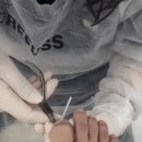 레푸스 구월점 내성발톱 무좀발톱 발각질 문제성발 이미지