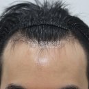 모먼트의원 이미지