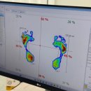 세라젬 부산연산점 | 부산 레푸스 연산 시청점 티눈 제거 가격과 후기