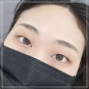 잠실 눈썹문신제거 2회차 시아브로우 후기!