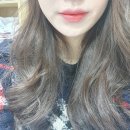 뽑기주사 얼굴 후기(5일차) - 시술 직후부터 일주일차까지 사진O 리얼효과있네 대박