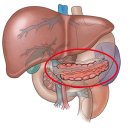 당뇨병(Diabetes mellitus)증상 이미지