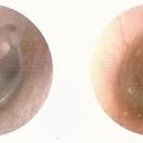 에바다보청기 이미지