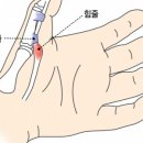 중외약국 네이버블로그
