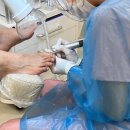 푸스케어 마곡점 | 마곡발톱무좀 | 풋케어 전문 푸스케어 마곡점 솔직 방문기