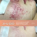 지우에너지 | 모공축소 핵심 솔루션, 지우지오로 달라지는 피부결! (봉천동피부관리 추천)