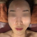 정명순내면미용 | 대구신부관리) 정명순 내면미용 솔직 후기✌️