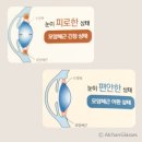 四字成語 총정리 ㅁ 147 모아면역~모우미성