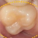 메디포레치과의원 이미지