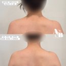 무니크뷰티(Moonique) | 부천 바디관리 상동 웨딩관리 추천 승모근과 자세 교정에 효과 좋은 바디관리 @무니크에어바디