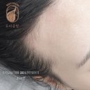 두피공방헤어라인