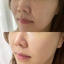 한일가스 산소 | 강남역 피부관리 네일헤몬 강남점 에이쁠뷰티 물광피부 만들기