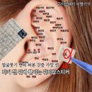 이혈(귀) 상담과 건강관리 | 써본것중 제일 쎈놈 귀지압스티커 헬씨이어 이혈기석 후기(귀지압점 손혈자리 붓기빼기 위치)