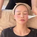온다필라테스 | 압구정로데오역 청담피부과 온다리프팅 내돈내산 후기 효과 만족해요