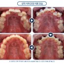 서울교정치과기공소 이미지