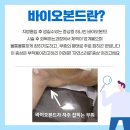 더올슬림