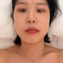 오일프라임 | 청담동 피부관리 더프라임바디케어｜인디바 리프팅으로 얼굴 윤곽·속건조 관리 후기