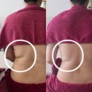 일산출장마사지 | 일산 마미라인에서 출장 산후 마사지 받은 솔직 후기(제왕절개 산모)