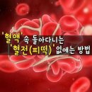 &#39;혈액&#39; 속 돌아다니는 &#39;혈전&#39; 없애는 방법 이미지