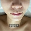 수앤미스킨케어