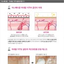 네오클린 이미지