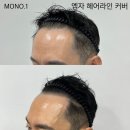모노원(MONO.1) | 탈모마술사 MONO.1