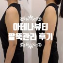 아테나스킨&바디 | 군자에스테틱 아테나뷰티, 광진구에스테틱 팔뚝 관리로 라인 잡기
