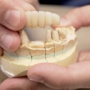에코치과기공소 이미지