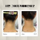 그여자의손 | [서면 그여자가예뻐진이곳] 서면 왁싱 결혼준비 뒷목 왁싱 받고온 후기!