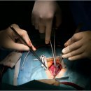 더행복한흉부외과의원 | 기침이 사라지지 않는데 어떤 변화가 필요할까요?