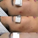 가정역 | [•뷰티·제품] 루원시티 피부관리, 나위시에스테틱 가정역점 (MTS 후기)