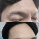 리사브로우 | 리사엘의 맨스브로우