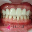 스마일라인치과기공소 이미지