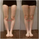 V라인경락마사지 이미지