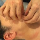 팔골 | 망원 관리샵 ㅣ 미플, 골근위 실루엣 나노테라피 솔직 후기